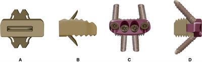 Comparison of the efficacy of ROI-C cage with Zero-P device in anterior cervical discectomy and fusion of cervical degenerative disc disease: a two-year follow-up study